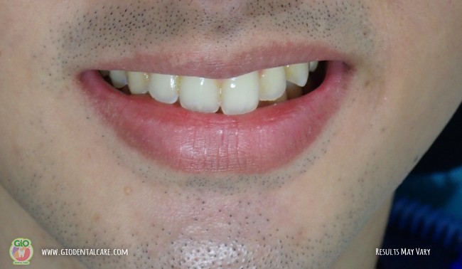 get-your-smile-here-